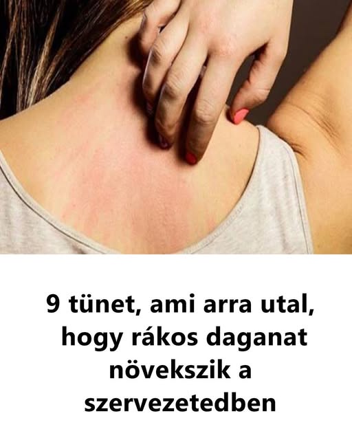 9 tunet ami arra utal