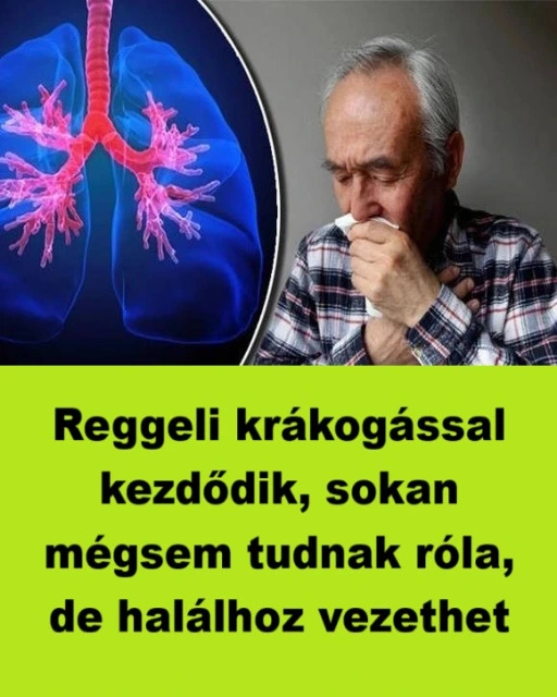 Reggeli krakogassal kezdodik