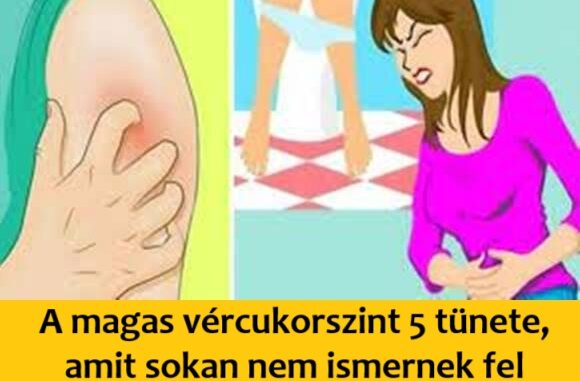 magascukor122