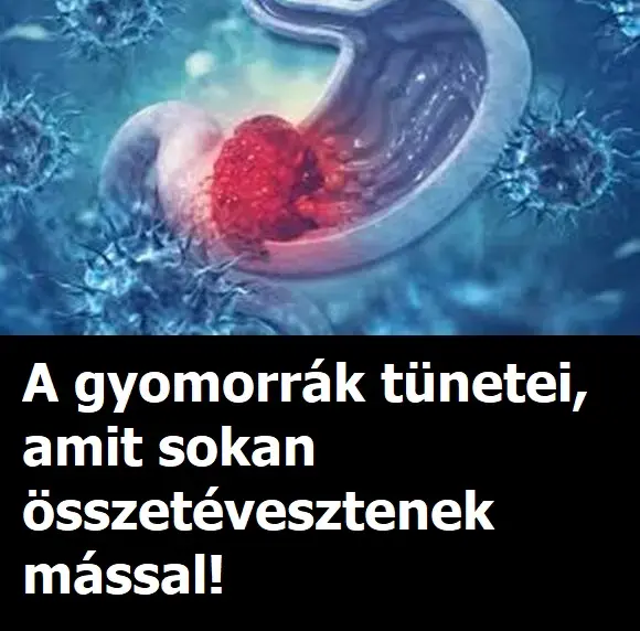 gyomorrak tunetei 580x381