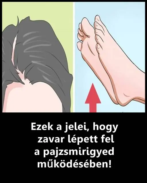 pajzsmirigy1364283965740798413 n