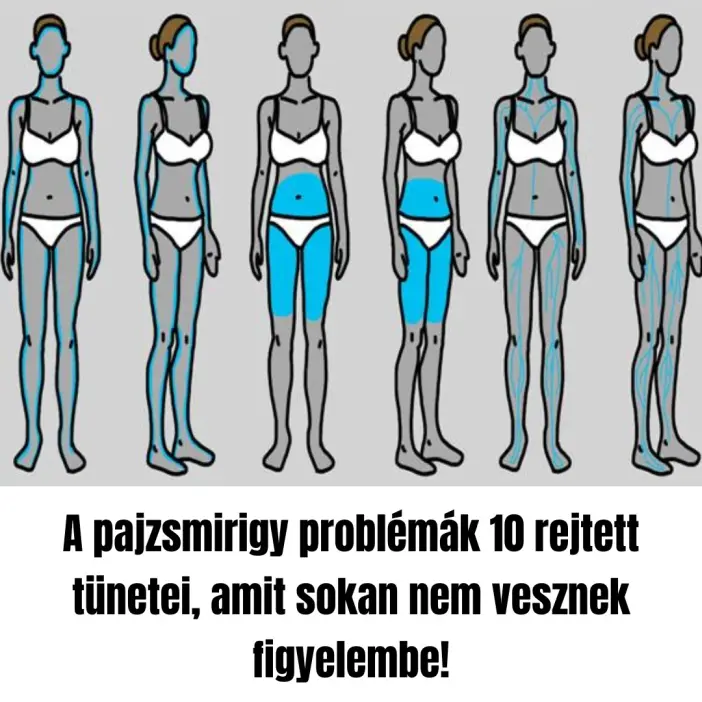 pajzsmirigy5089872 n