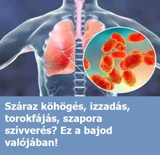 szarazkohogesx